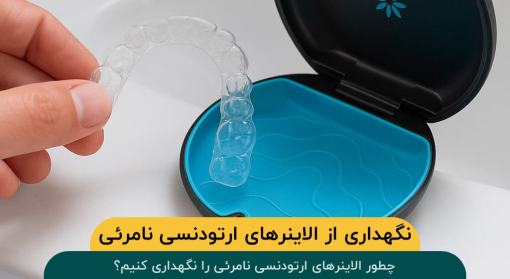 نگهداری-الاینرهای-ارتودنسی-نامرئی